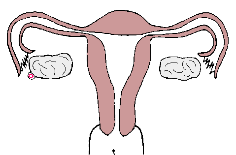 Embarazo ectopico
